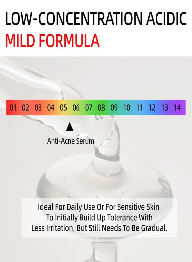 HKY - Acne Serum For Face, 1.5 Hour Blemish Blitz Emergency Anti Acne Treatment To Reduce Redness With Salicylic Acid, Niacinamide, Panthenol, Retinol - Prone Skin - Image 5